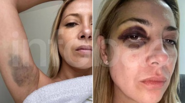 Revelan evidencias de violencia de género de Fabiola Yañez contra Alberto Fernández