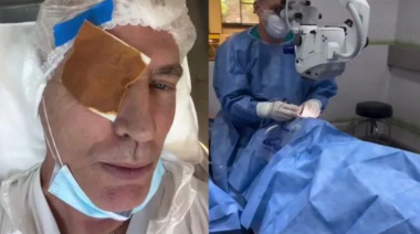 Marley se sometió a una cirugía en su ojo y compartió las imágenes del momento