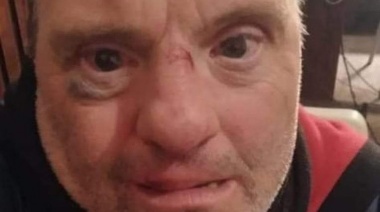 Golpearon a un vendedor con Síndrome de Down para robarle el celular