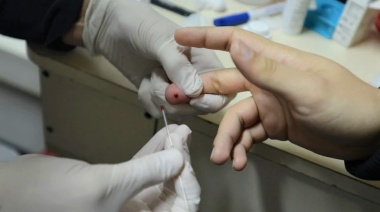 Se organiza jornada simultánea de testeo de HIV y Sífilis en seis CAPS del distrito