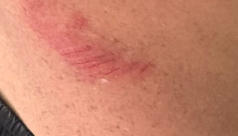 Ataque con piedras en el río: un nadador denuncia que fue herido