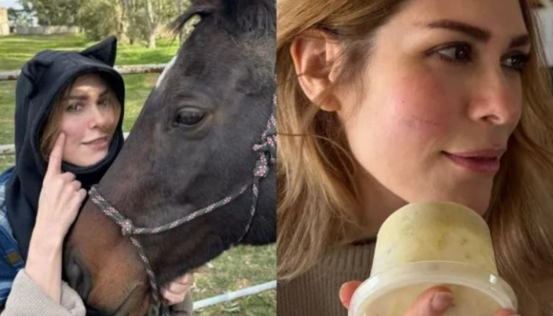 Lilia Lemoine anunció que se aleja de los medios tras sufrir un accidente por "montar a pelo": qué le pasó