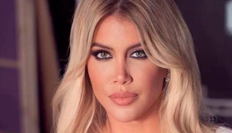 Wanda Nara compartió detalles de su tratamiento contra la leucemia: "Lo que no comparto con ustedes"