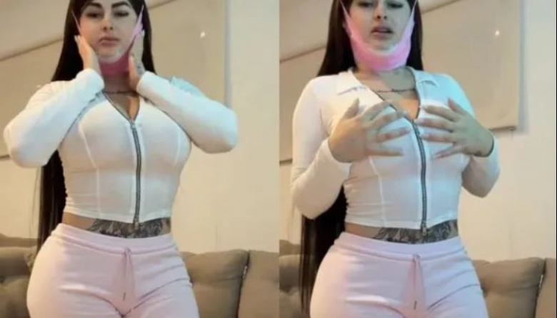 Kami Franco se hizo una cirugía estética, mostró el resultado y sorprendió a sus fans