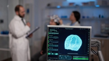 Día Mundial del ACV: Estadísticas y claves para prevenir la enfermedad