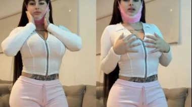 Kami Franco se hizo una cirugía estética, mostró el resultado y sorprendió a sus fans